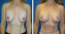 Before & After Photos